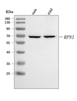 Anti-RPN1 Antibody Picoband® Boster Bio