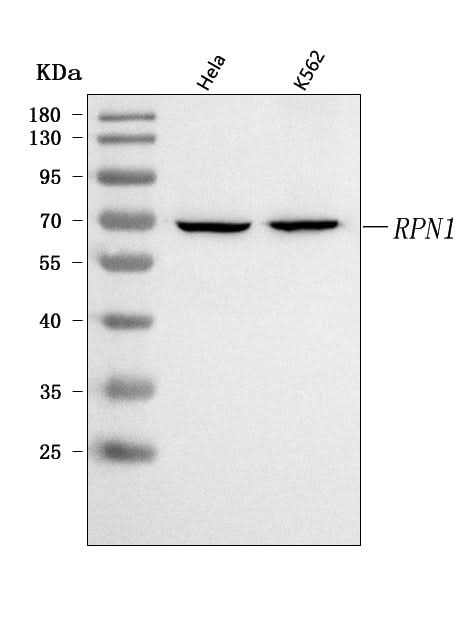 Anti-RPN1 Antibody Picoband® Boster Bio