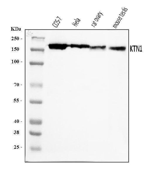 Anti-Kinectin 1/KTN1 Antibody Picoband® Boster Bio