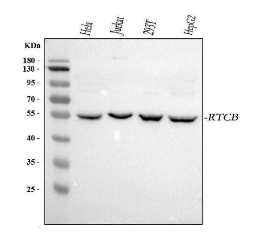 Anti-RTCB Antibody Picoband® Boster Bio