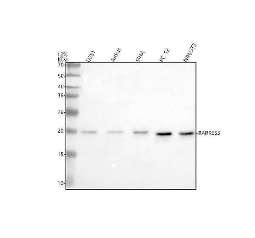 Anti-RARRES3/PLAAT4 Antibody Picoband® Boster Bio