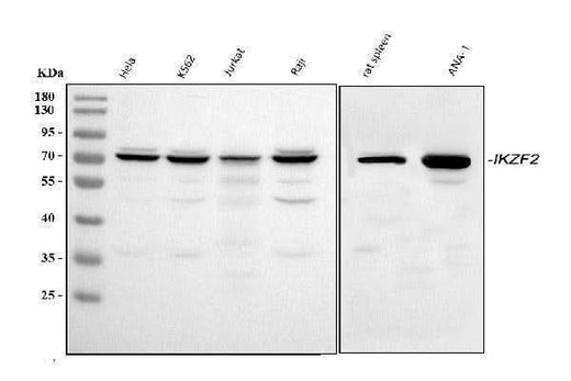 Anti-ZNFN1A2/HELIOS/IKZF2 Antibody Picoband® Boster Bio