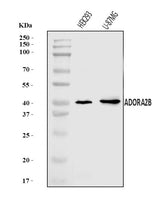 Anti-ADORA2B Antibody Picoband® Boster Bio