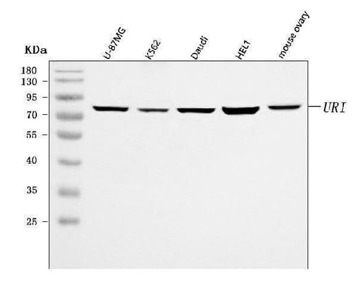 Anti-C19orf2/URI1 Antibody Picoband® Boster Bio