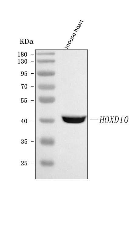 Anti-HOXD10 Antibody Picoband® Boster Bio