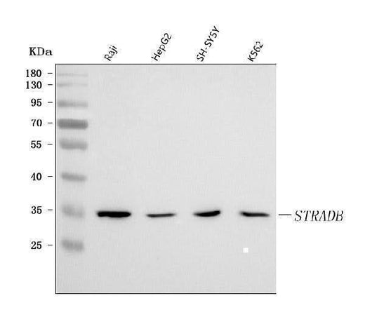 Anti-STRADB Antibody Picoband® Boster Bio