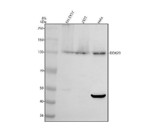 Anti-DDX20 Antibody Picoband® Boster Bio
