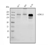 Anti-CDK13 Antibody Picoband® Boster Bio