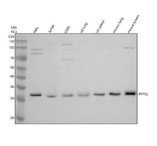 Anti-DNAJB11 Antibody Picoband® Boster Bio