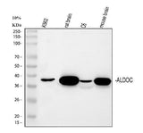 Anti-Aldolase C/ALDOC Antibody Picoband® Boster Bio