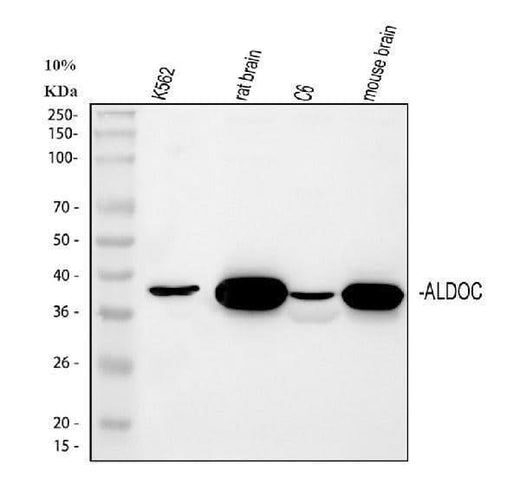 Anti-Aldolase C/ALDOC Antibody Picoband® Boster Bio