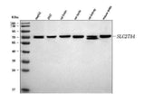 Anti-FATP4/SLC27A4 Antibody Picoband® Boster Bio