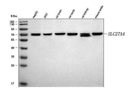 Anti-FATP4/SLC27A4 Antibody Picoband® Boster Bio