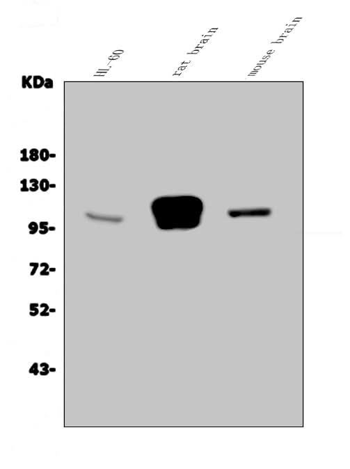 Anti-GRID2 Antibody Picoband® Boster Bio