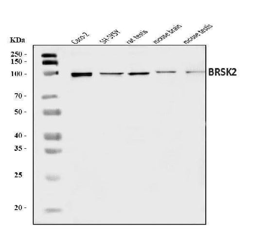 Anti-BRSK2 Antibody Picoband® Boster Bio