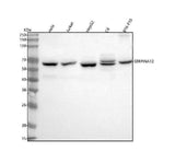 Anti-Vaspin/SERPINA12 Antibody Picoband® Boster Bio