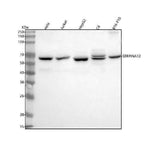 Anti-Vaspin/SERPINA12 Antibody Picoband® Boster Bio