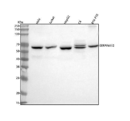Anti-Vaspin/SERPINA12 Antibody Picoband® Boster Bio