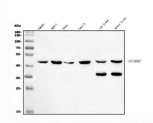 Anti-KMT1B/SUV39H2 Antibody Picoband® Boster Bio