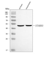 Anti-MLN64/STARD3 Antibody Picoband® Boster Bio
