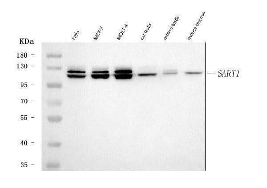 Anti-SART1 Antibody Picoband® Boster Bio