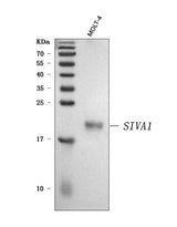 Anti-SIVA/SIVA1 Antibody Picoband® Boster Bio