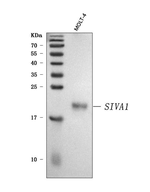 Anti-SIVA/SIVA1 Antibody Picoband® Boster Bio