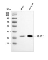 Anti-RLBP1 Antibody Picoband® Boster Bio