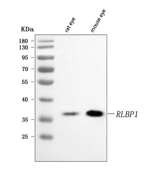 Anti-RLBP1 Antibody Picoband® Boster Bio