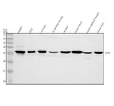 Anti-ETFB Antibody Picoband® Boster Bio