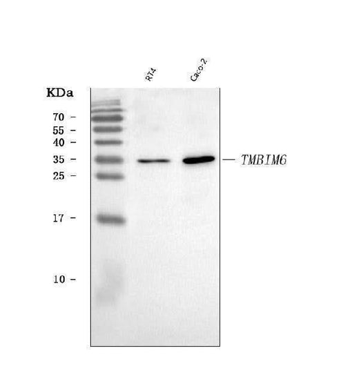 Anti-BI-1/TMBIM6 Antibody Picoband® Boster Bio