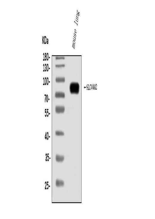 Anti-SLC44A2 Antibody Picoband® Boster Bio
