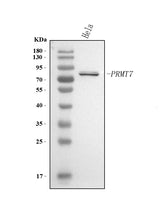 Anti-PRMT7 Antibody Picoband® Boster Bio