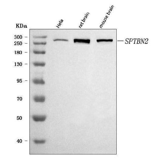Anti-SPTBN2 Antibody Picoband® Boster Bio
