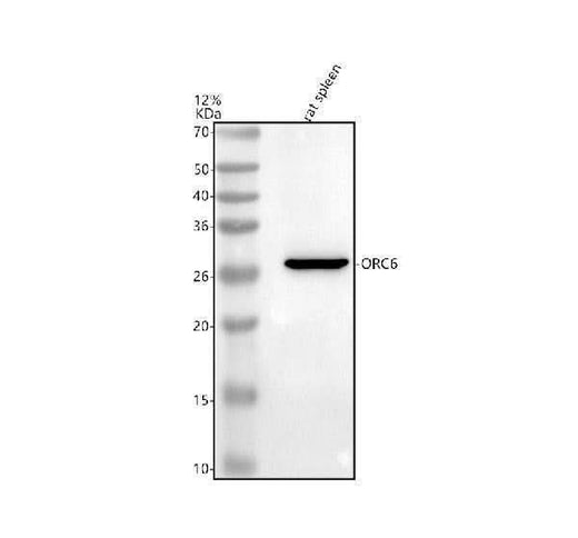 Anti-ORC6 Antibody Picoband® Boster Bio