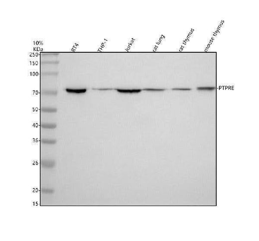 Anti-PTPRE Antibody Picoband® Boster Bio