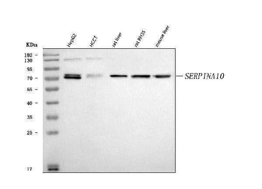 Anti-ZPI/SERPINA10 Antibody Picoband® Boster Bio