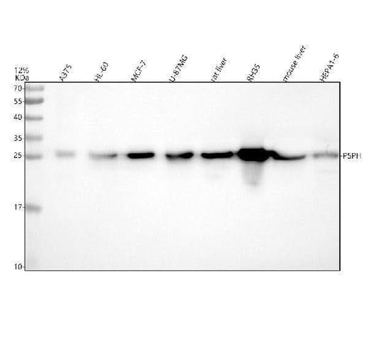 Anti-PSPH Antibody Picoband® Boster Bio