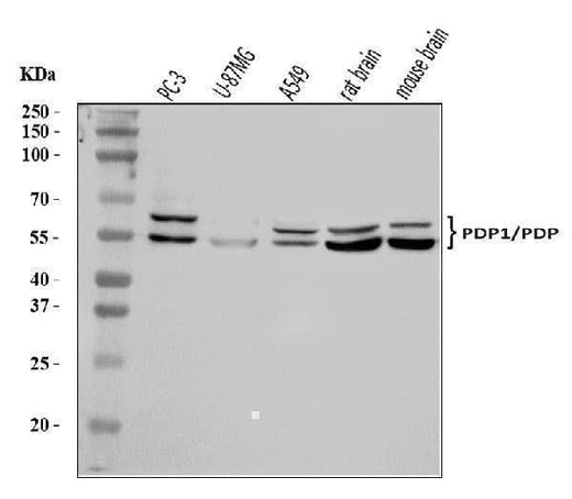 Anti-PDP1/PDP Antibody Picoband® Boster Bio