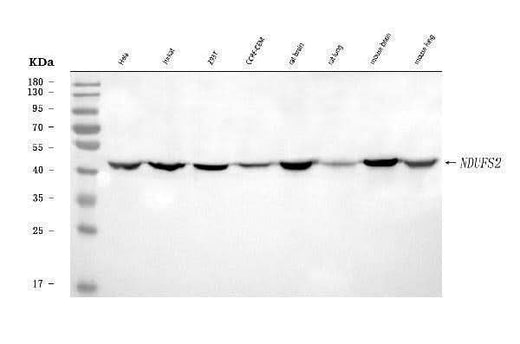 Anti-NDUFS2 Antibody Picoband® Boster Bio