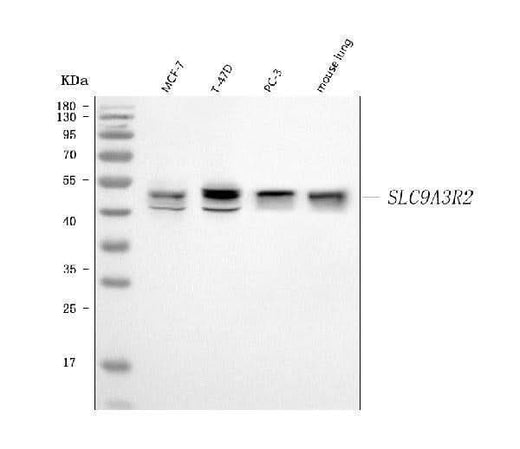 Anti-NHERF-2/SIP-1/SLC9A3R2 Antibody Picoband® Boster Bio