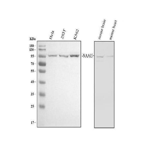 Anti-NARG1/NAA15 Antibody Picoband® Boster Bio