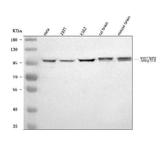 Anti-NARG1/NAA15 Antibody Picoband® Boster Bio