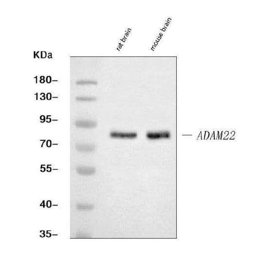 Anti-ADAM22 Antibody Picoband® Boster Bio