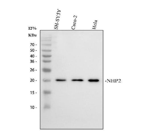 Anti-NHP2 Antibody Picoband® Boster Bio
