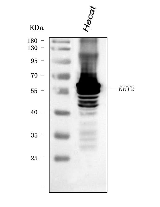 Anti-Cytokeratin 2e/KRT2 Antibody Picoband® Boster Bio