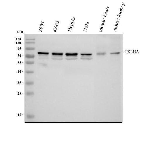 Anti-Alpha Taxilin/TXLNA Antibody Picoband® Boster Bio