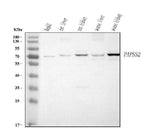 Anti-PAPSS2 Antibody Picoband® Boster Bio