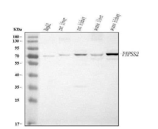 Anti-PAPSS2 Antibody Picoband® Boster Bio