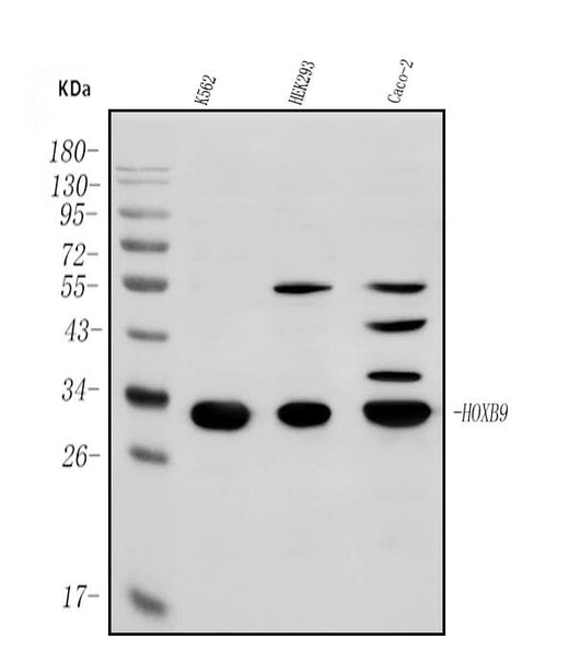 Anti-HOXB9 Antibody Picoband® Boster Bio